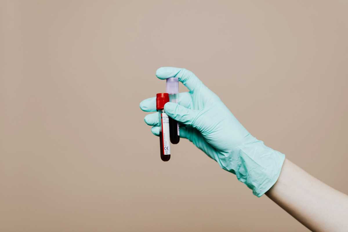 Key Markers in Blood Work That Suggest Chronic Disease Onset